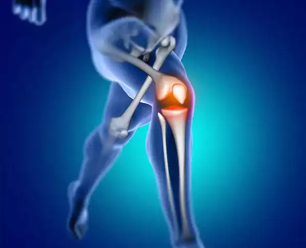 Revision Knee Prosthesis
