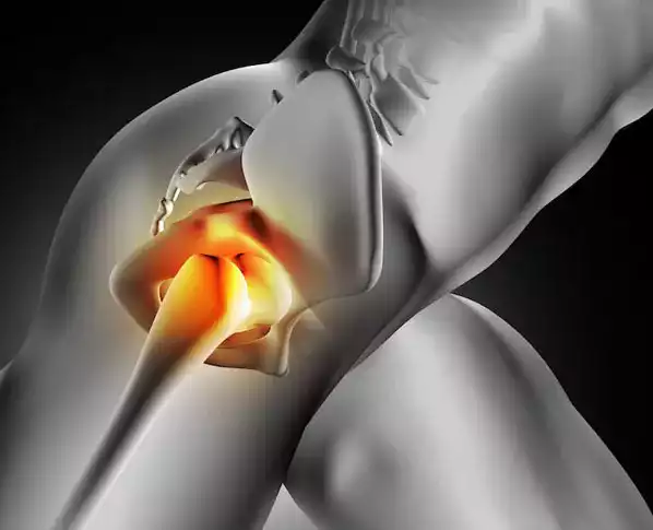 Total Hip Replacement
