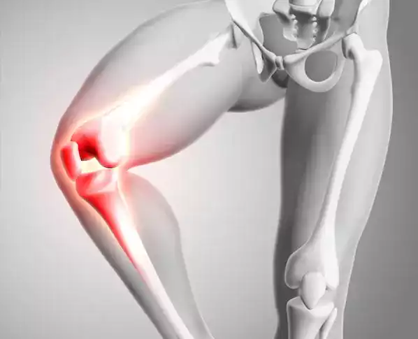 Hinged Knee Prosthesis
